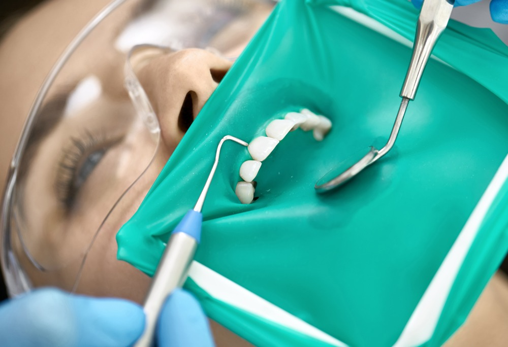 Root Canals and Endodontic Treatment