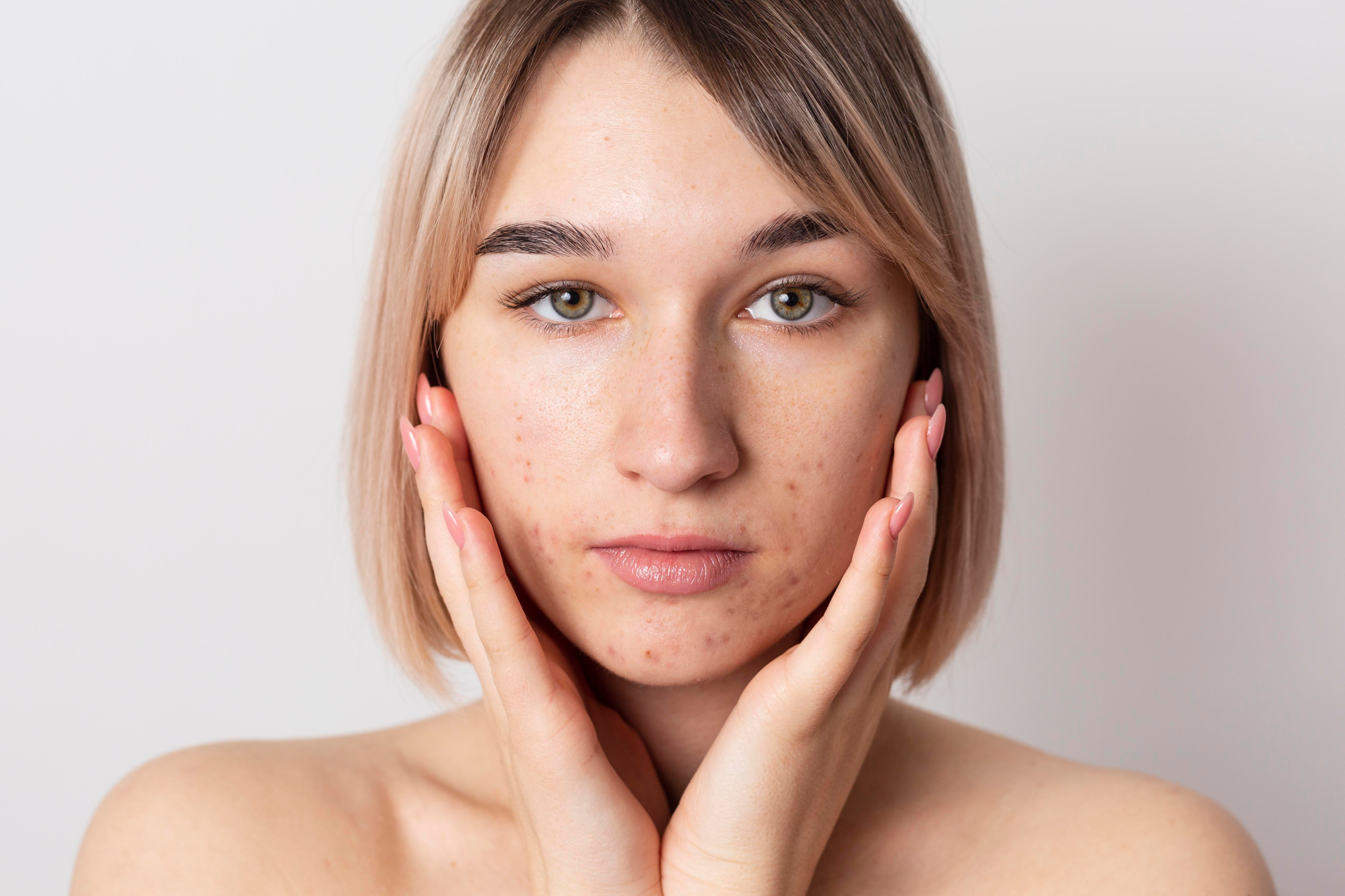 skincare and skin treatments