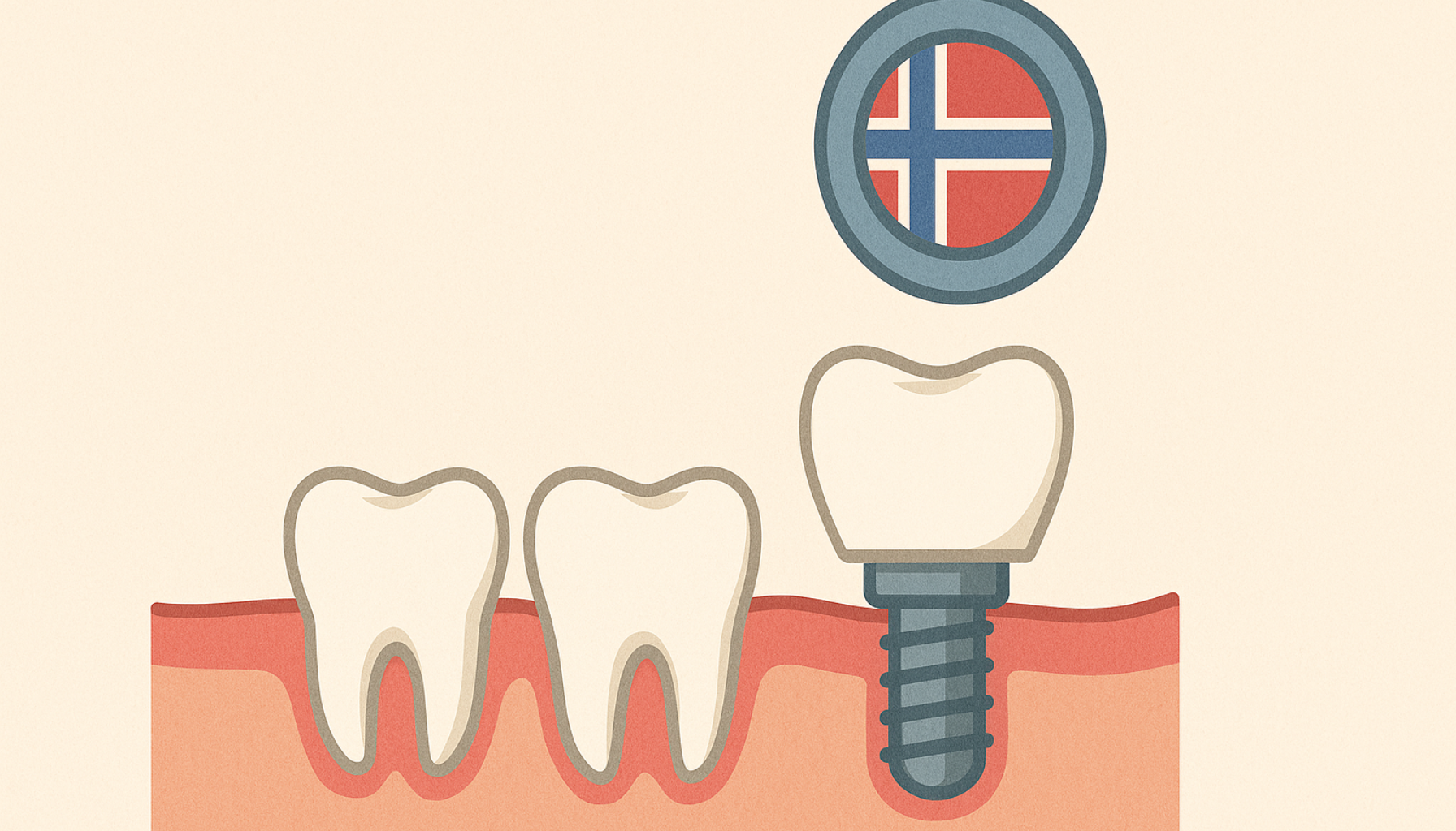 Tannimplantat i Norge: Hva Du Bør Vite Før Du Velger 16 Illustrasjon av tannimplantat ved siden av naturlige tenner, plassert i tannkjøttet med norsk flagg i bakgrunnen.