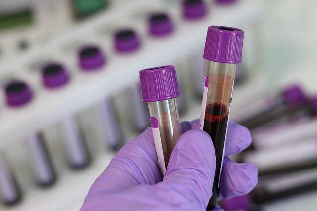 Blood testing of hormone levels and other biomarkers like PSA is a key component to TRT