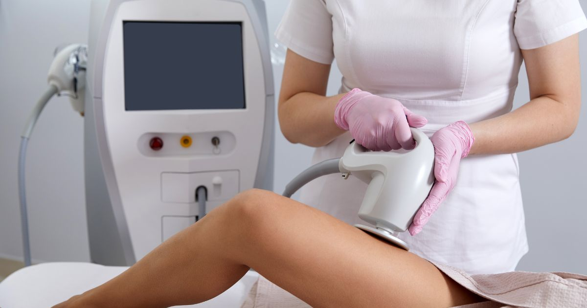 A woman receiving a laser treatment for cellulite reduction