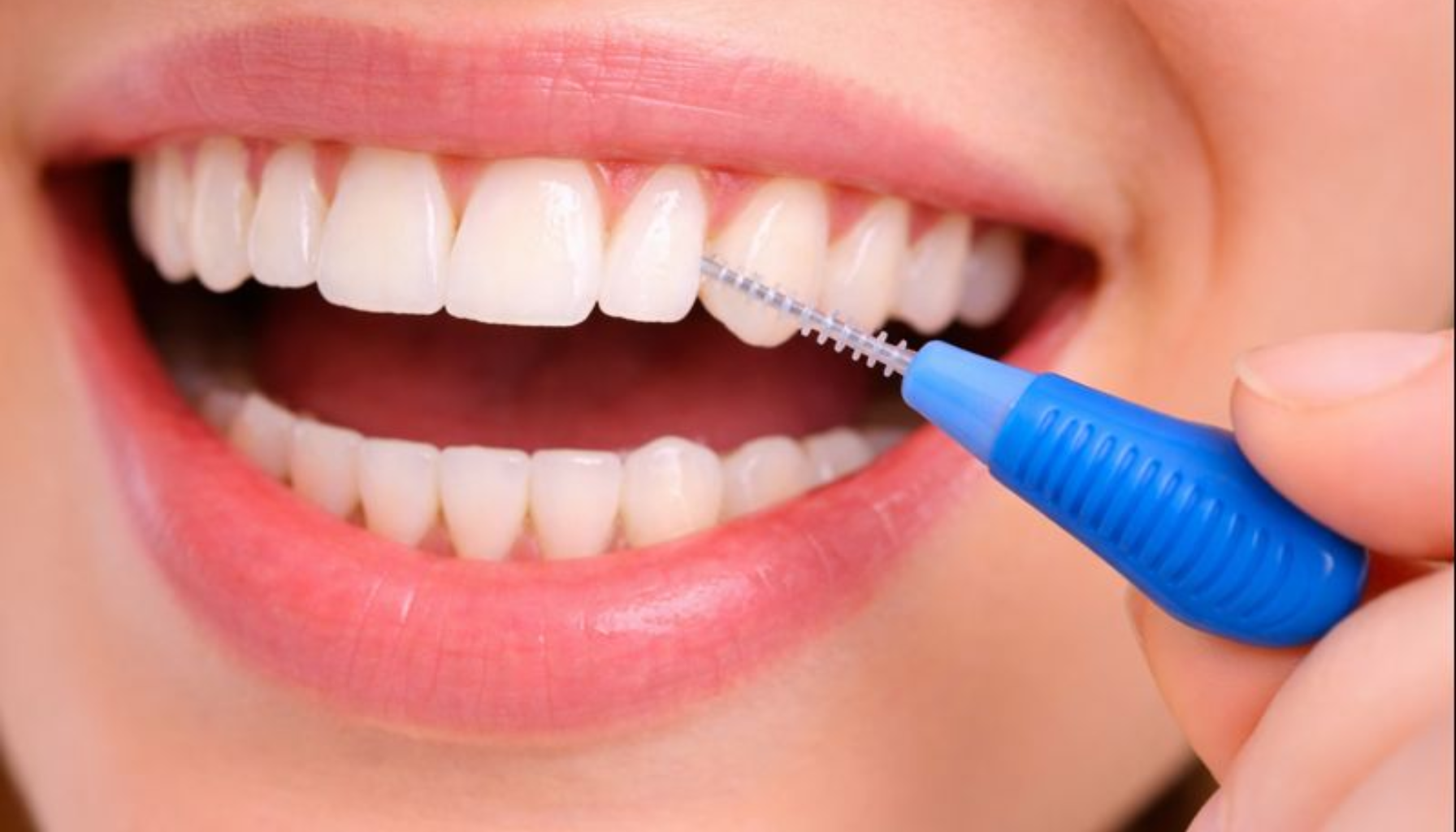 Mellomromsbørste: Det Beste Verktøyet for Renhold Mellom Tennene 12 Nærbilde av munn der interdentalbørste rengjør mellom tennene for bedre munnhygiene og forebygging av tannkjøttproblemer hjemme daglig