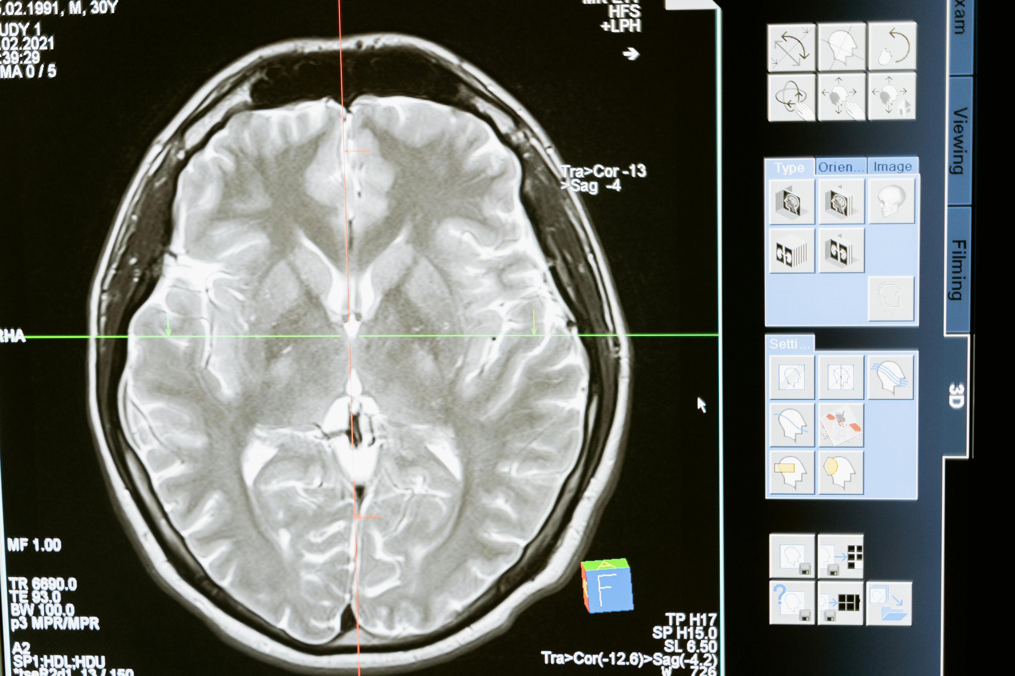 Scientists use functional magnetic resonance imaging to view the brain's structure