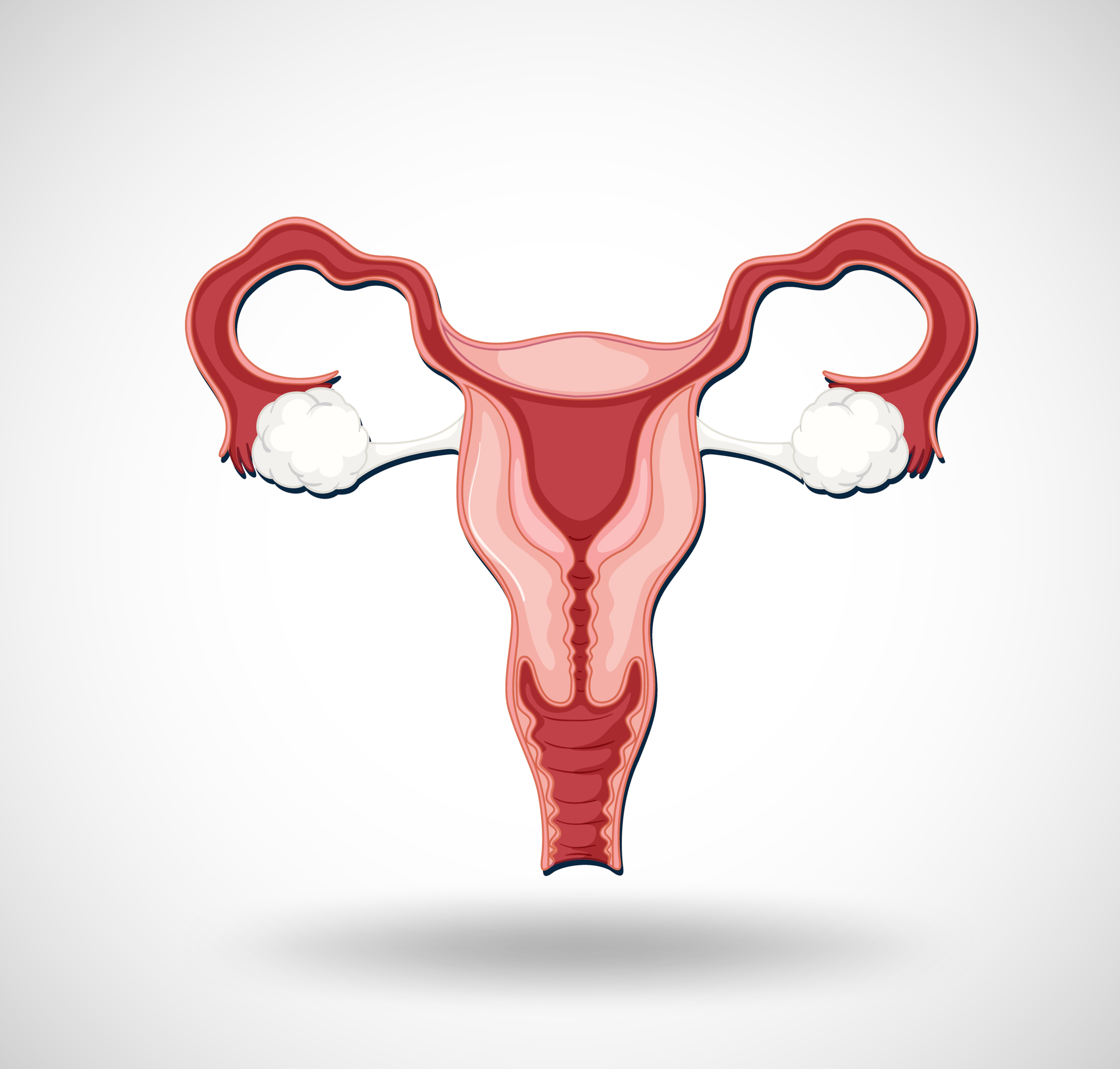 The cervix joins the body of the uterus with the vagina.
