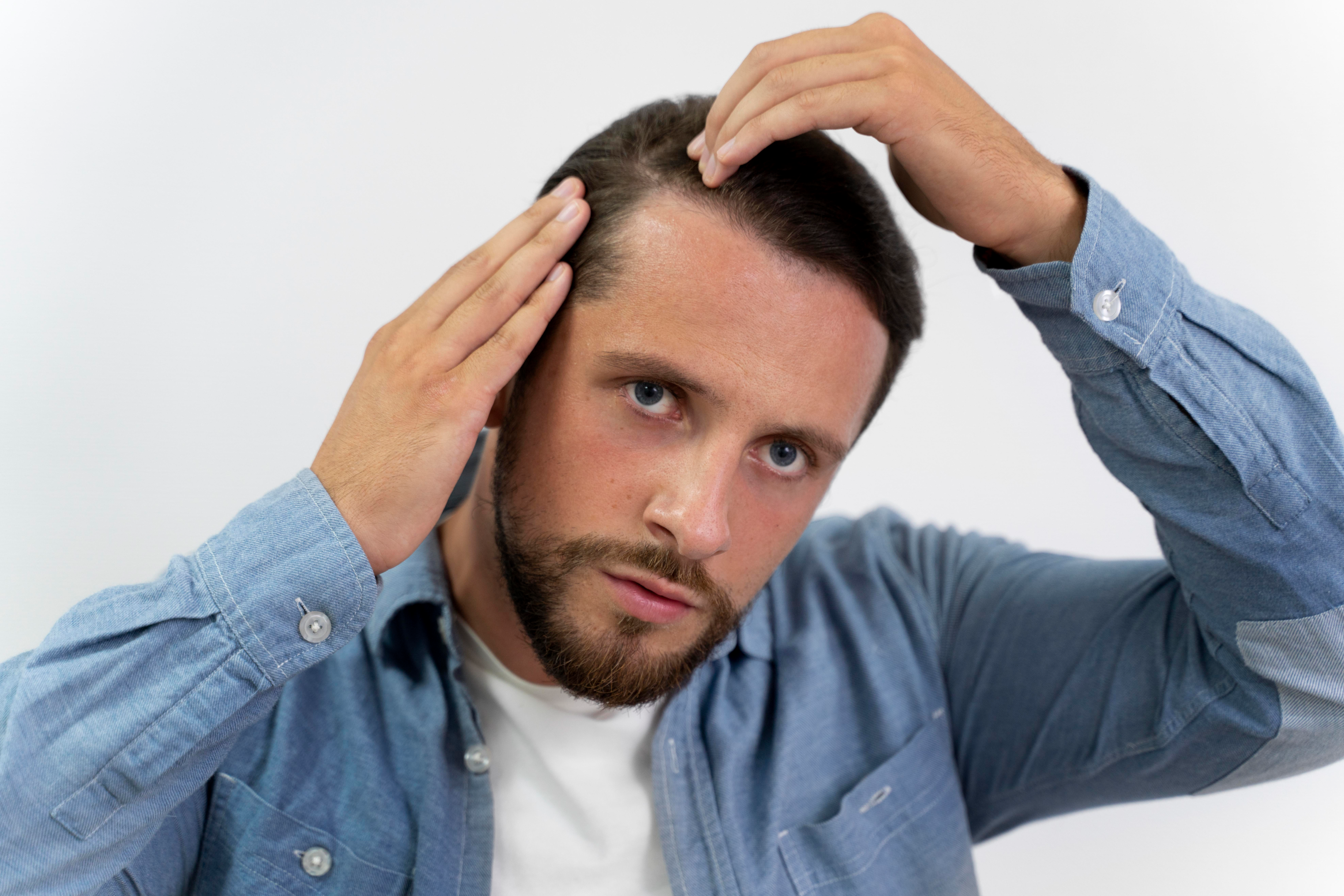 How does DHT cause hair loss? balding male hair loss