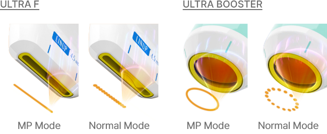 Energy Delivery Method (Linear mode and circular dot & linear combination mode)