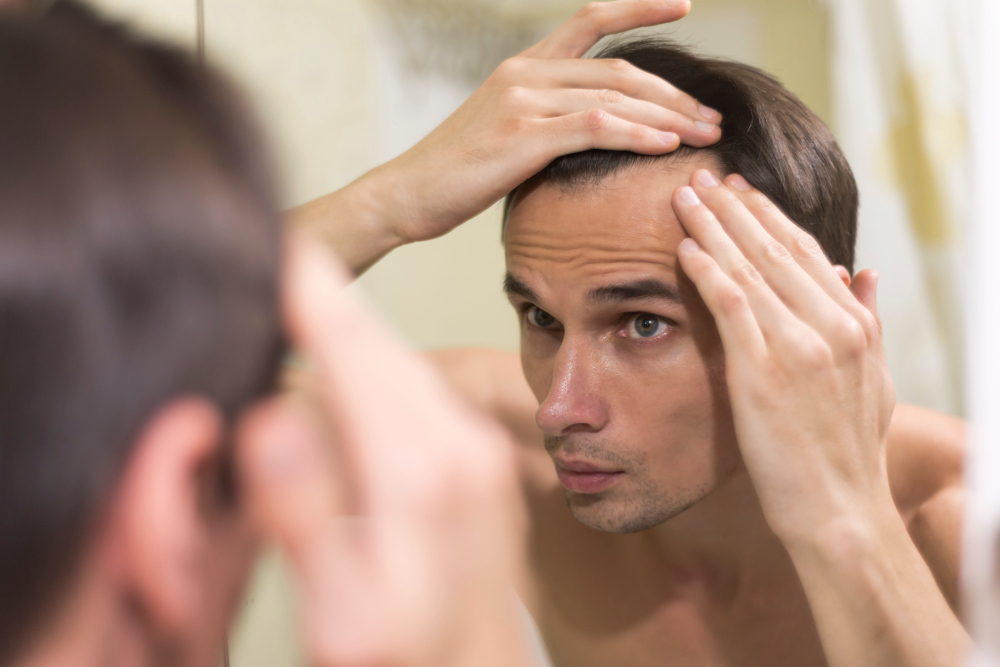 male pattern hair loss and male pattern baldness