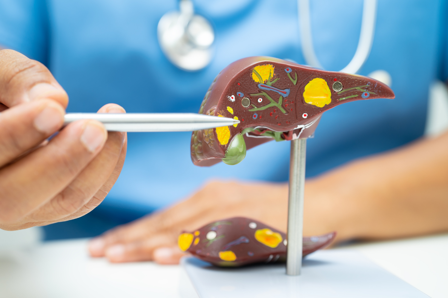Health professional pointing on a liver model.