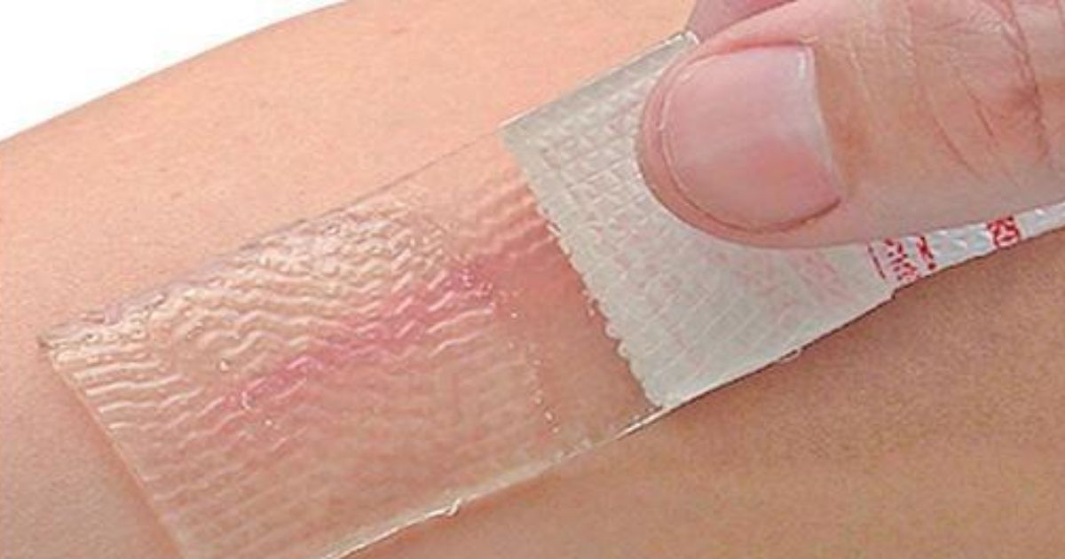 A person using silicone sheeting to manage their scar