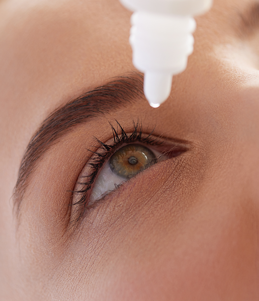 Dry eye treatment in Honolulu - pictured here is a patient using drops that have been specifically prescribed for their type of dry eye disease.