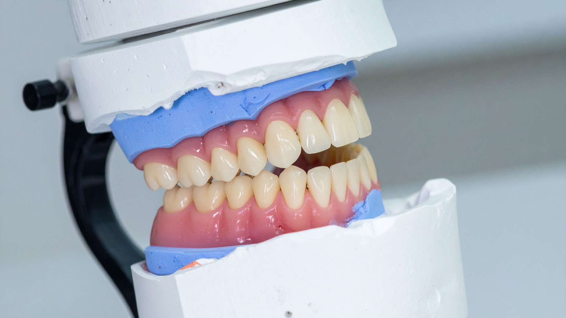 Dentures being shown before they are inserted into the mouth.