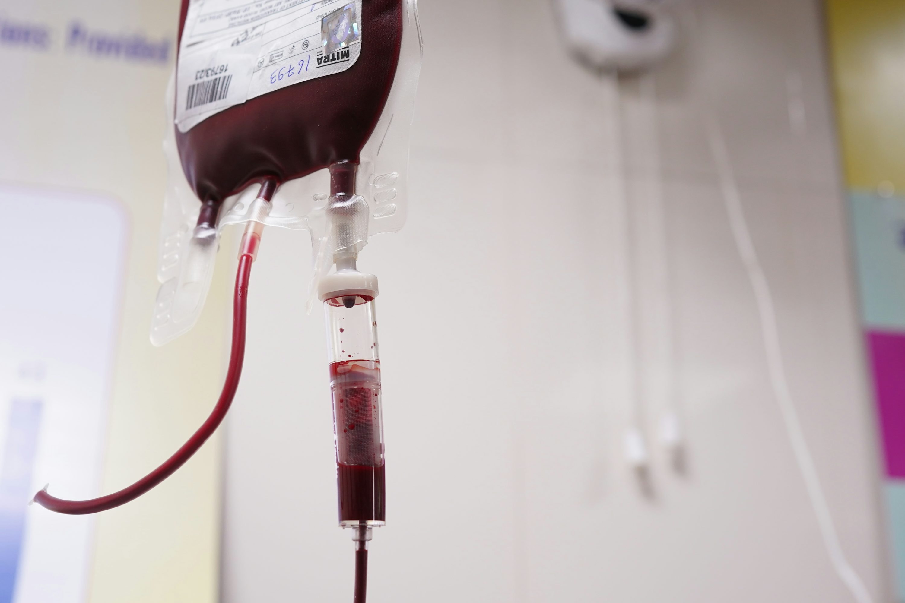 How Long After a Tattoo Can You Donate Blood? 2 Blood transfusion in process - Looking to donate blood but just got a tattoo? You may have to wait 3 months before donating.