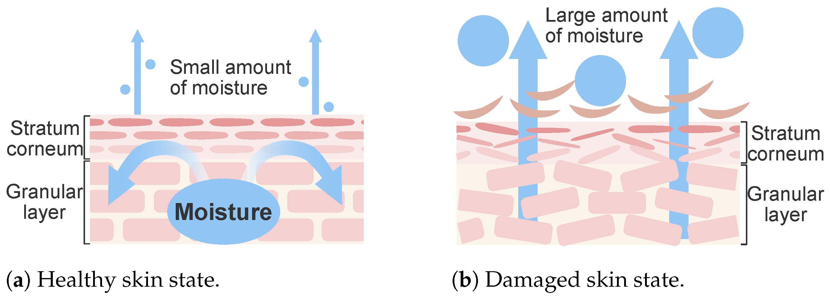 The stratum corneum in healthy and damaged skin status