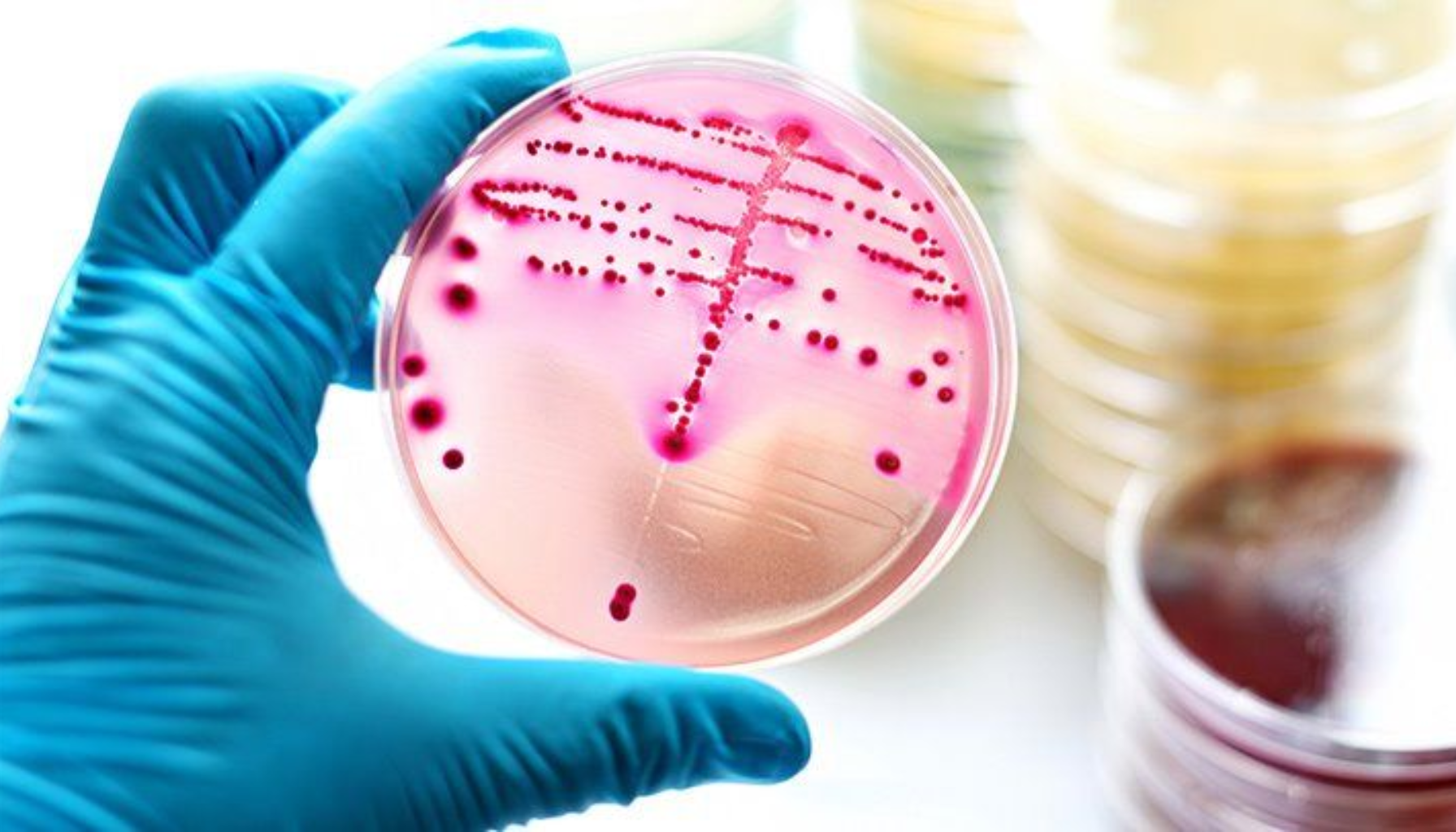 Laboratorietallerken med bakteriekolonier i rosa medium.