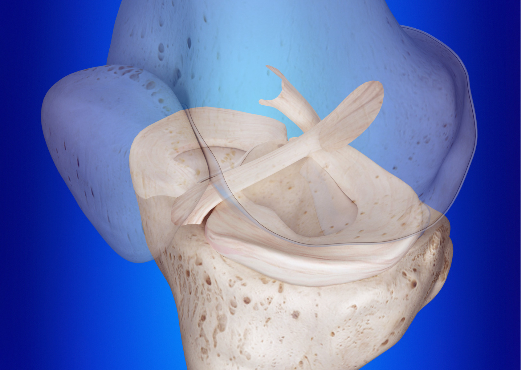 knee ligament injuries - PCL