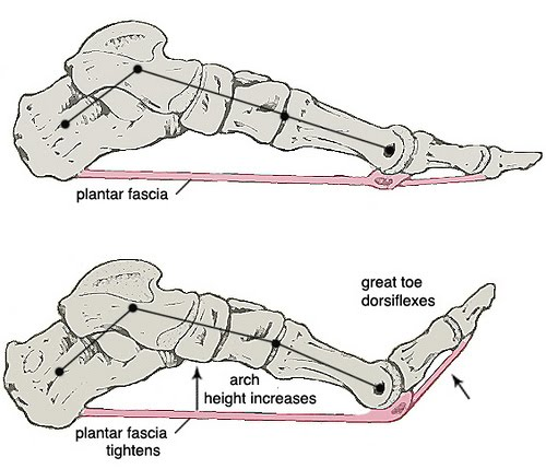 Anatomy of the plantar aspect of the foot demonstrating the bands