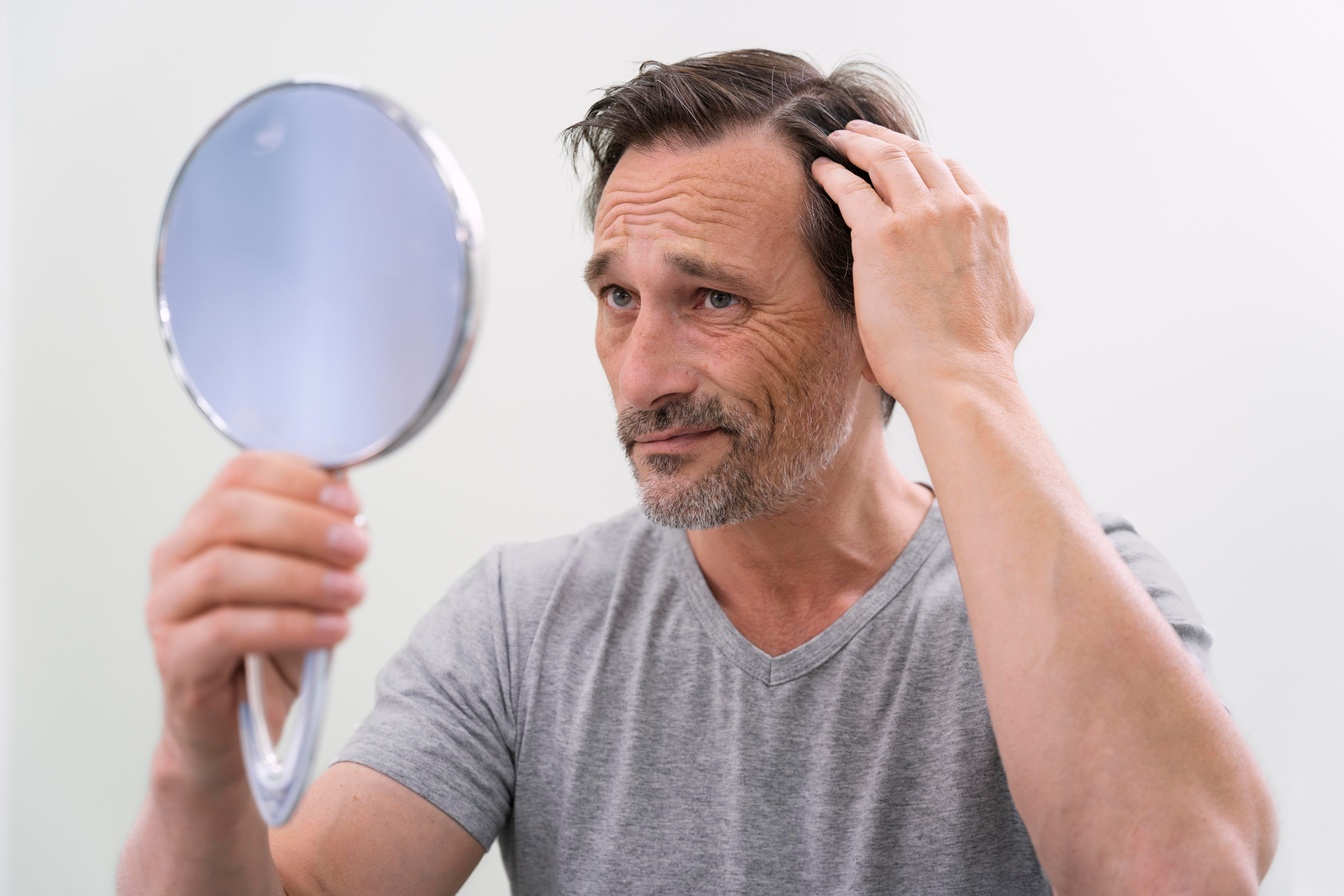 male pattern baldness is common especially for those without thicker hair find medical treatments and other ways to promote healthy hair