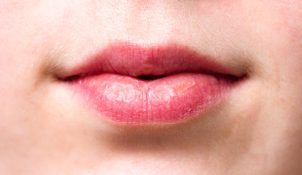 Gepflegte Lippen können Lippenherpes vorbeugen (Bild via pixabay)