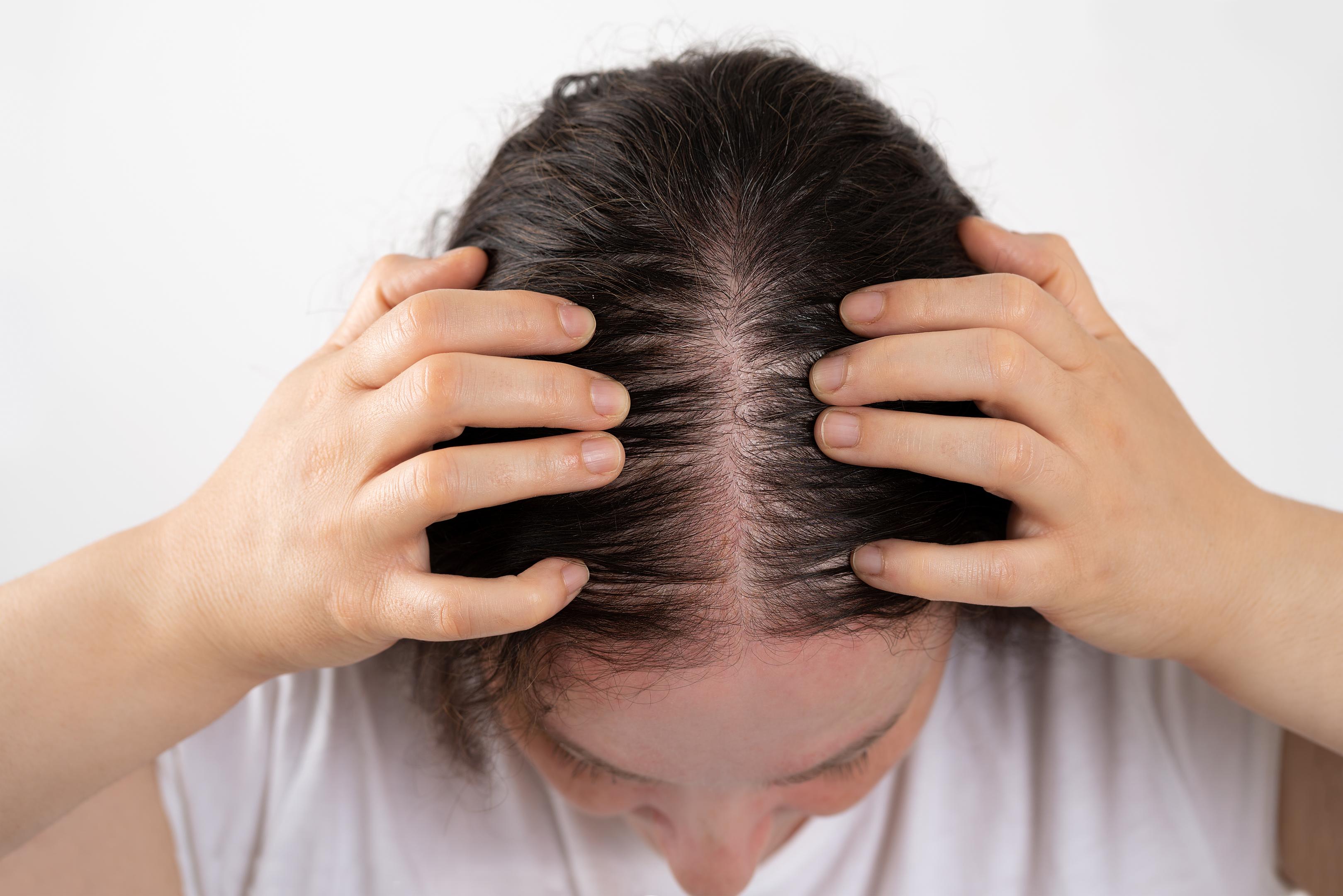 woman with baby fine hair