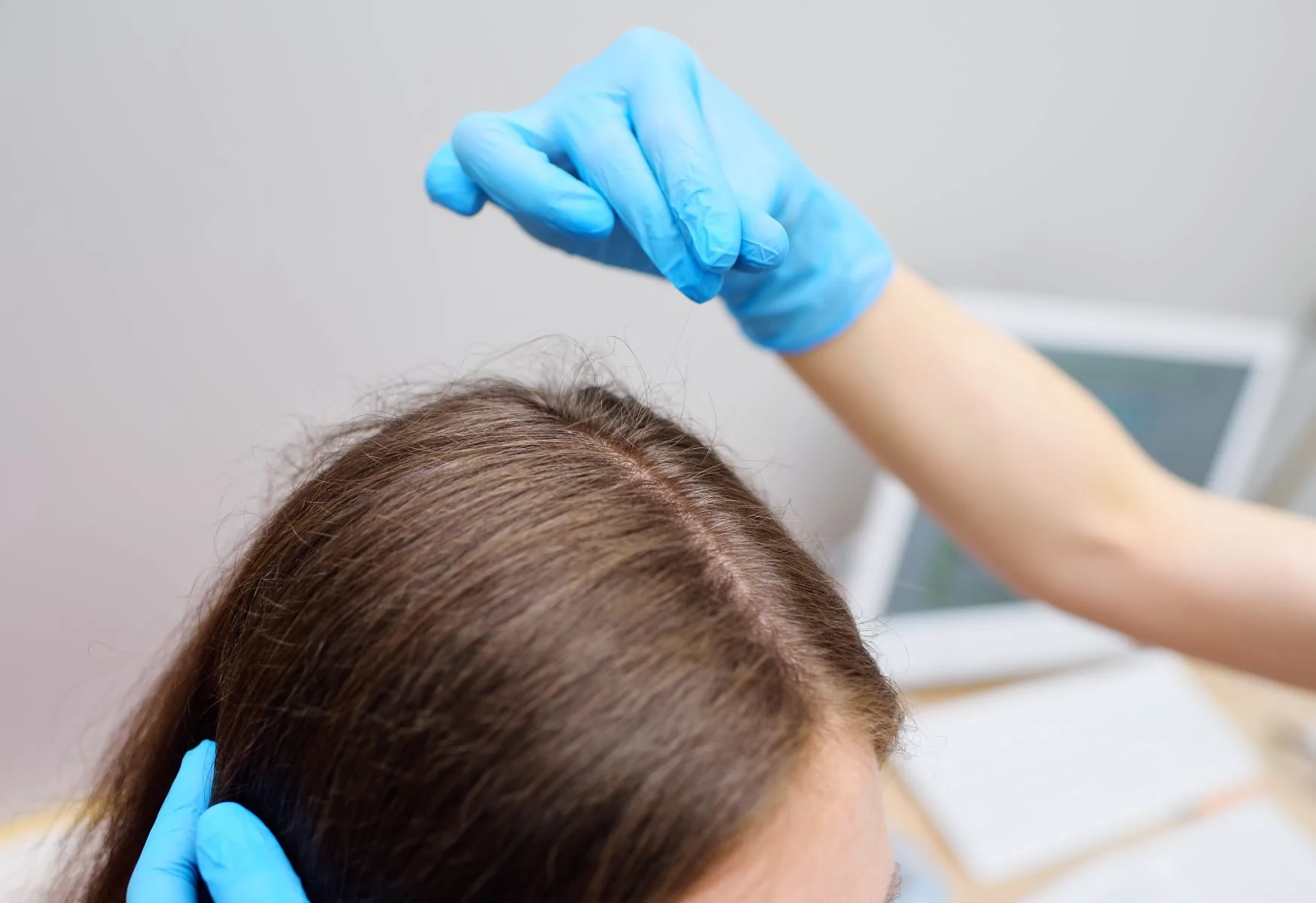 Hair Loss After Surgery - Potential Causes and Tested Cures