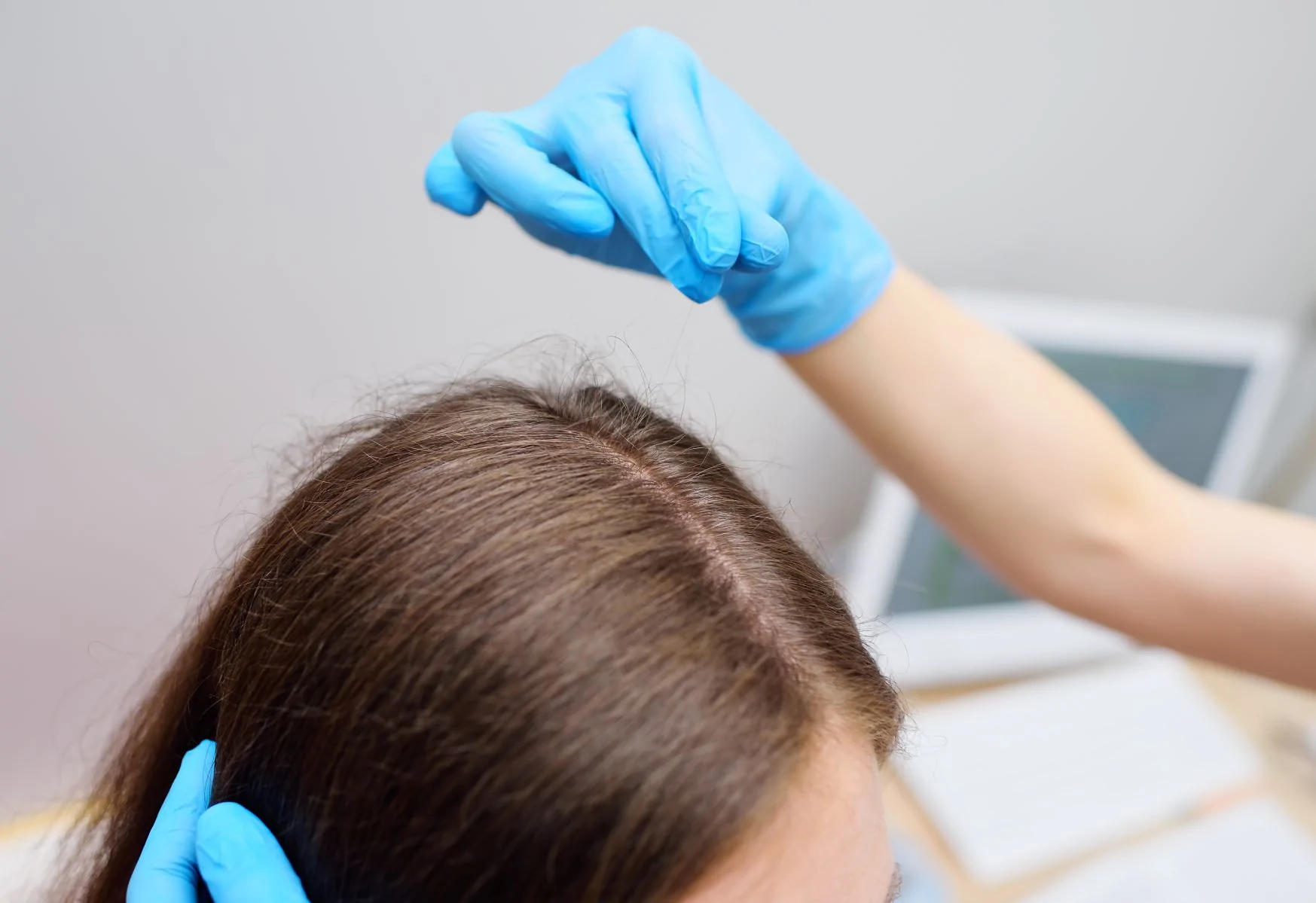 thinning hair, scalp hair, surgical procedure