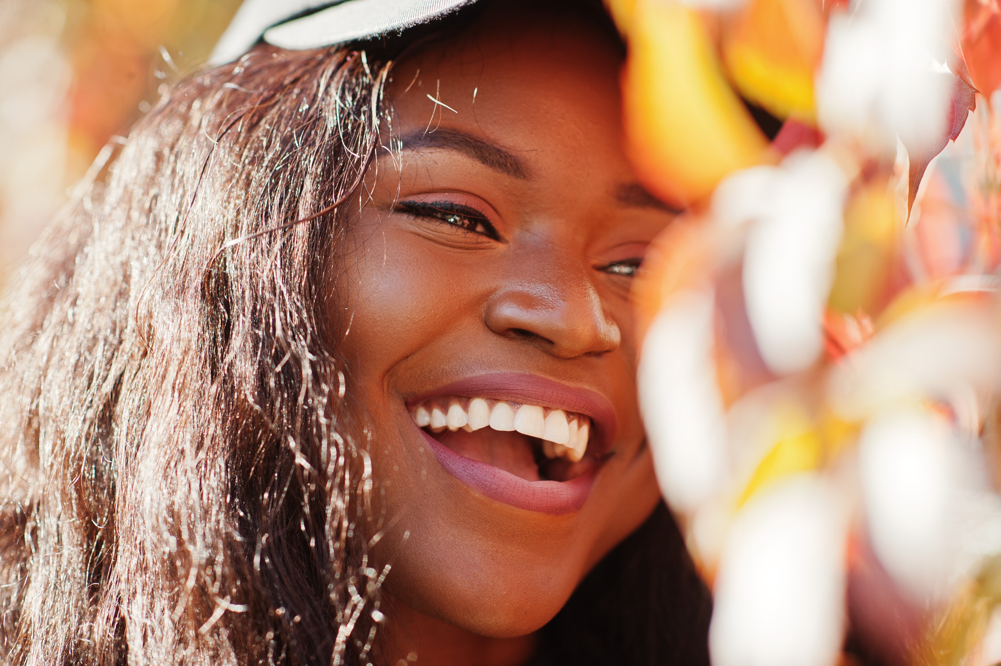 A happy young woman having fully recovered from corrective jaw surgery for underbite