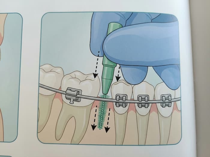 Post-Brushing Tools to Boost Cleanliness