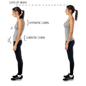 Posture before and after