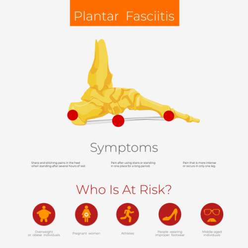 symptoms of plantar fasciitis pain in the foot
