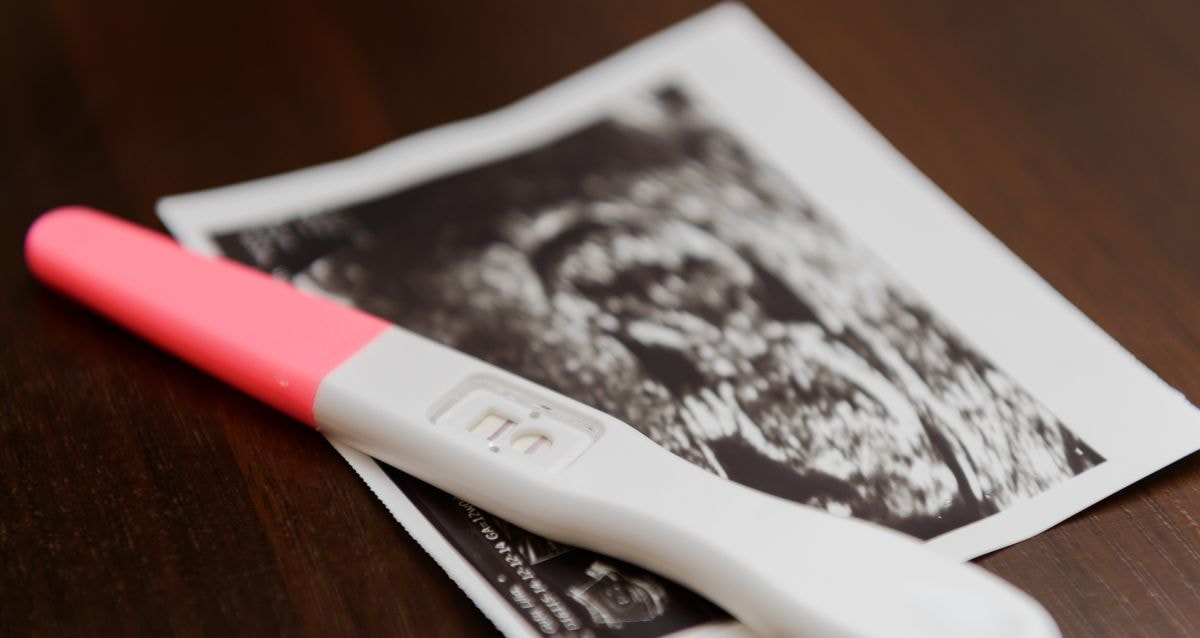 Women over a certain age have higher risks associated with diminished egg quality 