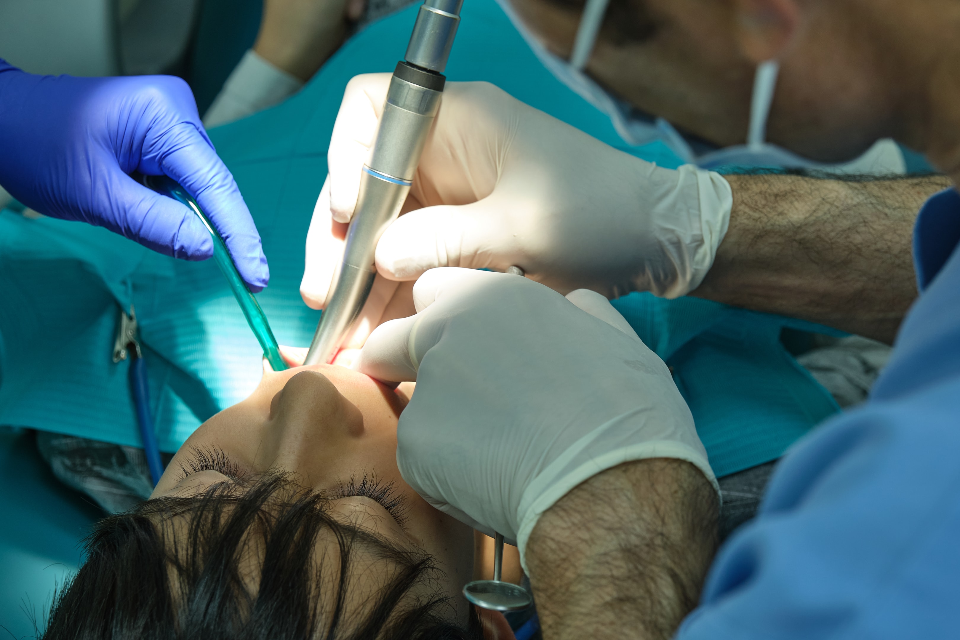 An image of an oral surgeon checking for any harmful bacteria.