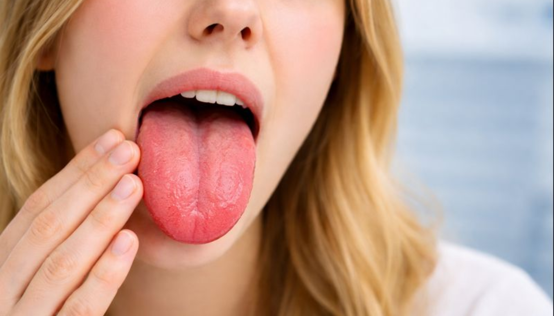 Hoven Tunge: Når Hevelse Gjør Det Ubehagelig å Snakke og Spise 11 Kvinne viser frem rød og hoven tunge, holder seg til kinnet med uttrykk av ubehag i ansiktet.