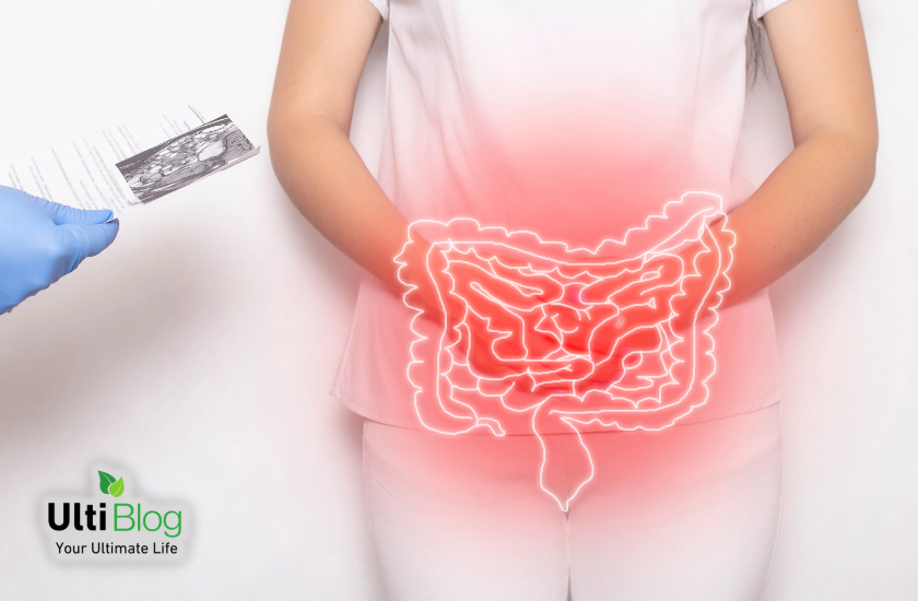Dysbiosis is an imbalance of gut bacteria in a post about Does Alcohol Kill Gut Bacteria?
