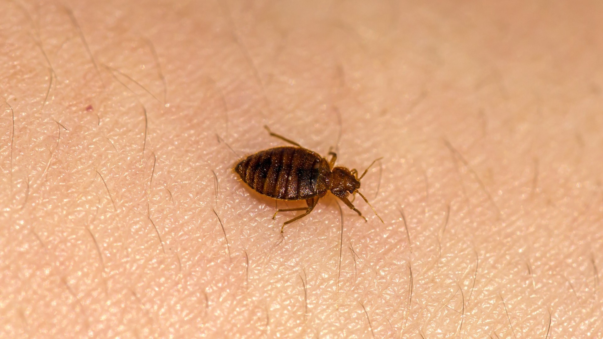 A bed bug crawls along human skin.