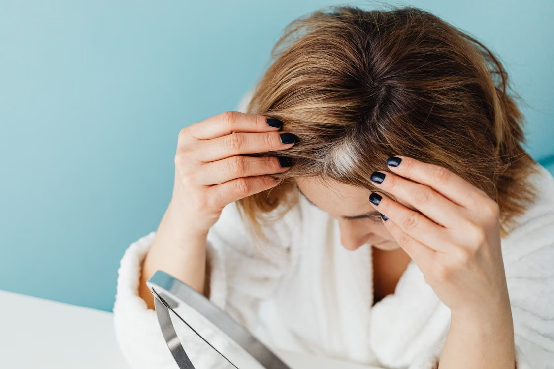 thinning hair