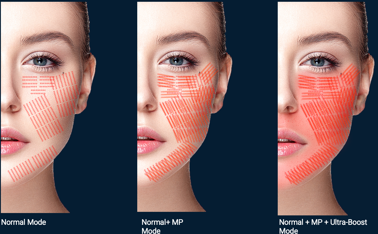 Energy delivery on face indication
