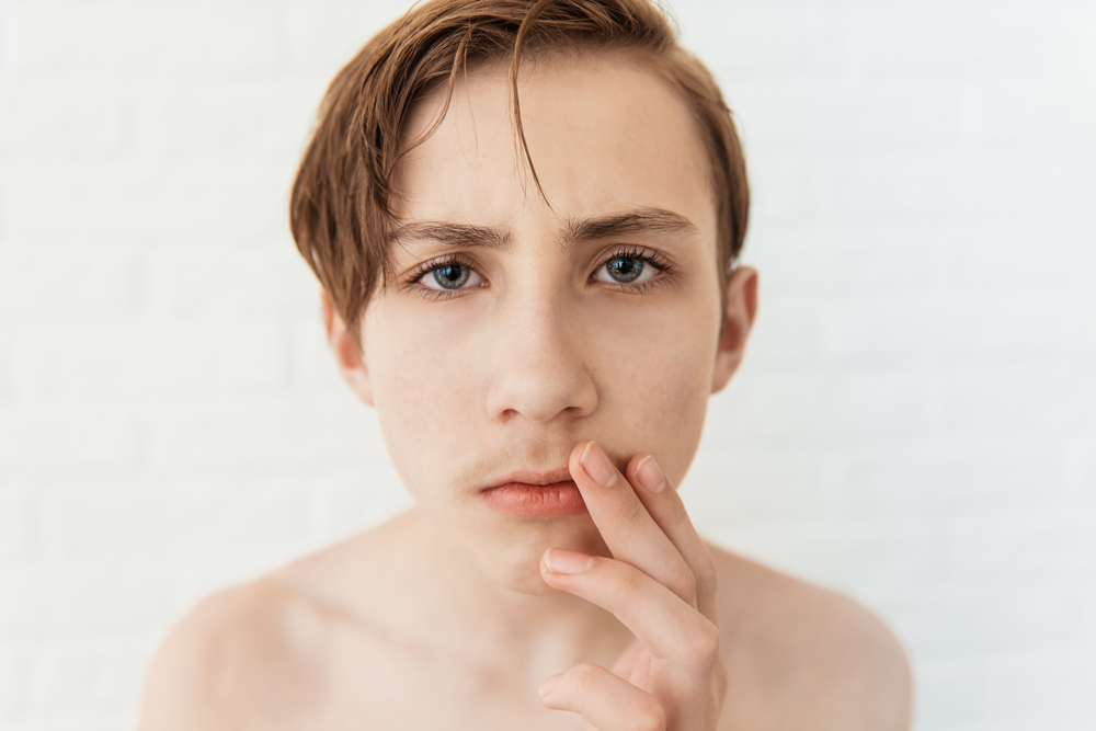 Young man with smooth chin and very light moustache coverage