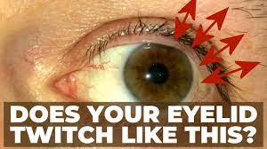 Eyelid spasms, Twitches, twitching driving me crazy. Upper eye lid  vibrating, is this normal? - YouTube