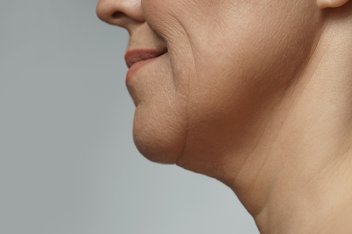 The formation of a facial wrinkle can prematurely age us, Botox can treat with little to no pain when injected into the muscle by a professional.