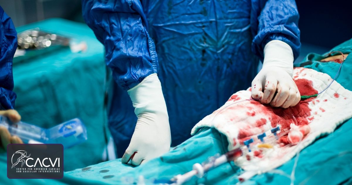 Before and After Vascular Surgery | What to Expect