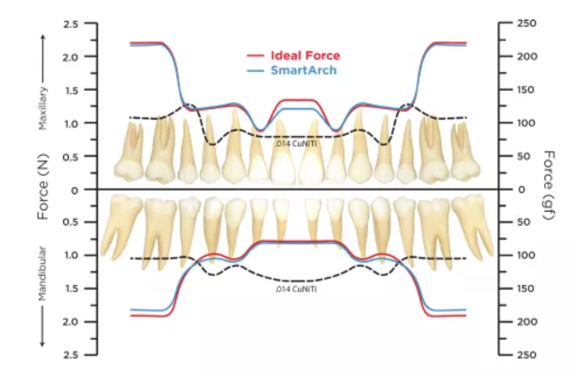 Does Invisalign Hurt as much as metal braces? About the same with smartarch