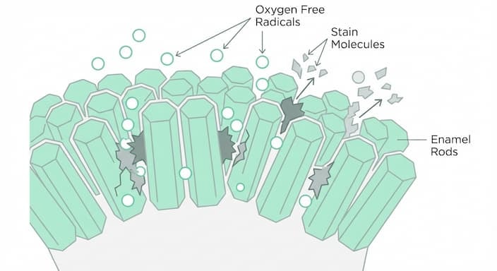 How Does Teeth Whitening Work