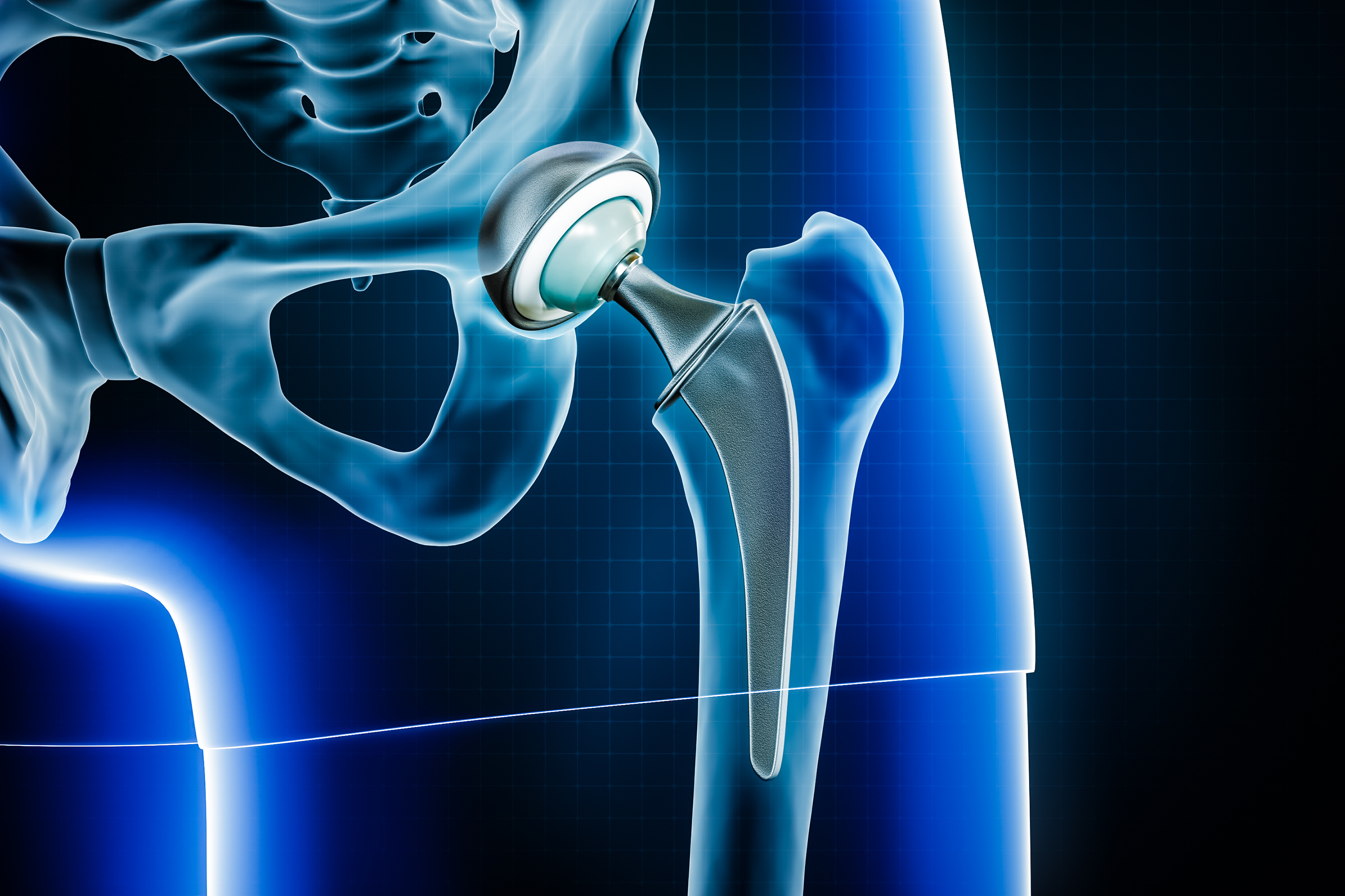 outpatient total joint replacement
