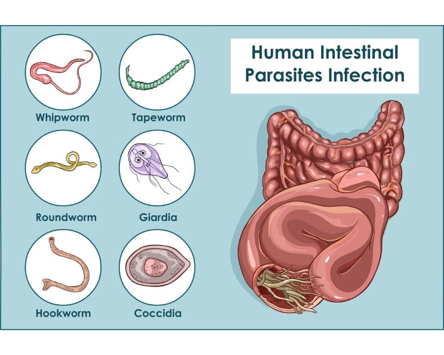 Diagram of human intestines with common parasites (tapeworm, roundworm, giardia) — educational visual for Parasite Cleanse context.