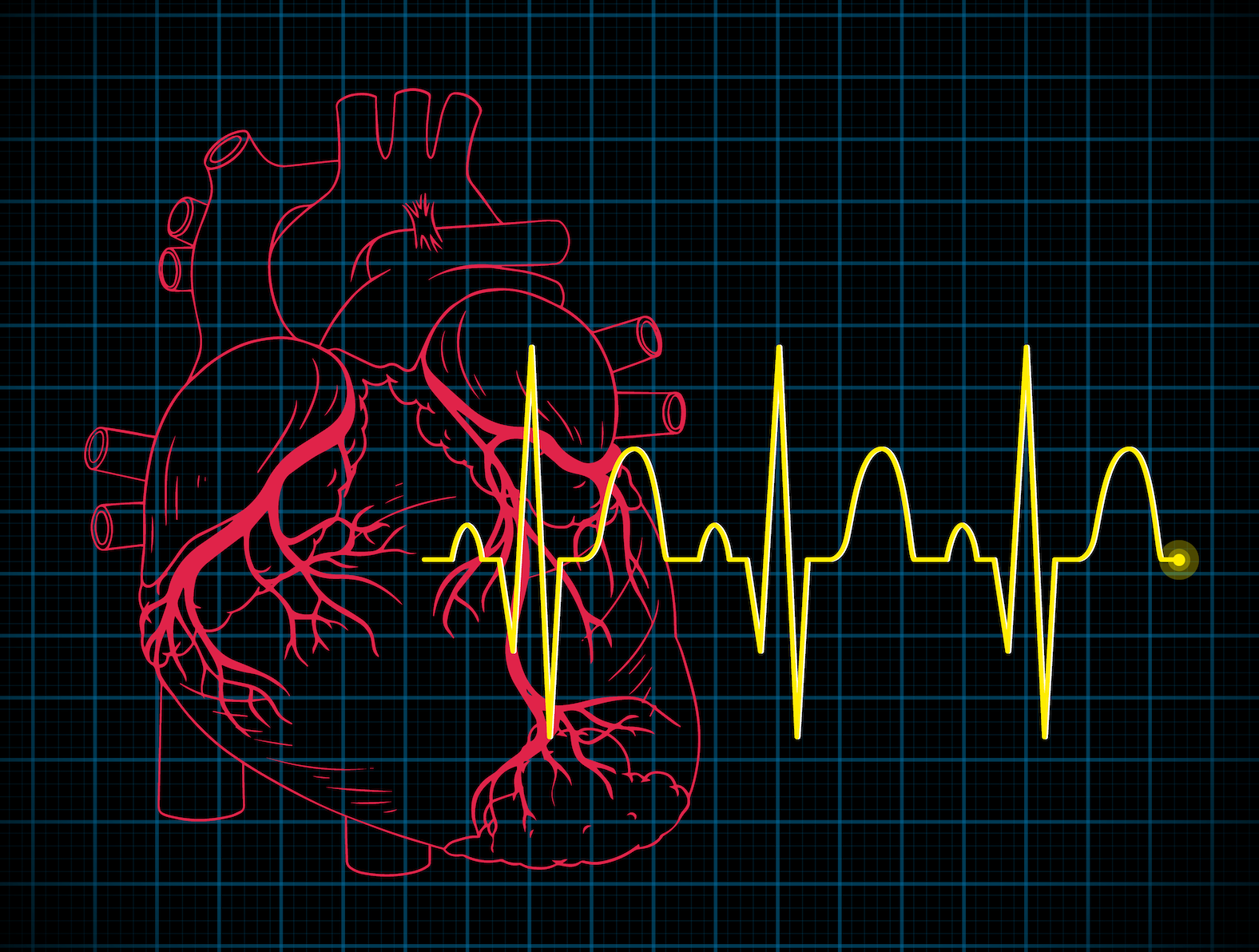 Heart CT vs Echocardiogram vs ECG for Early Detection