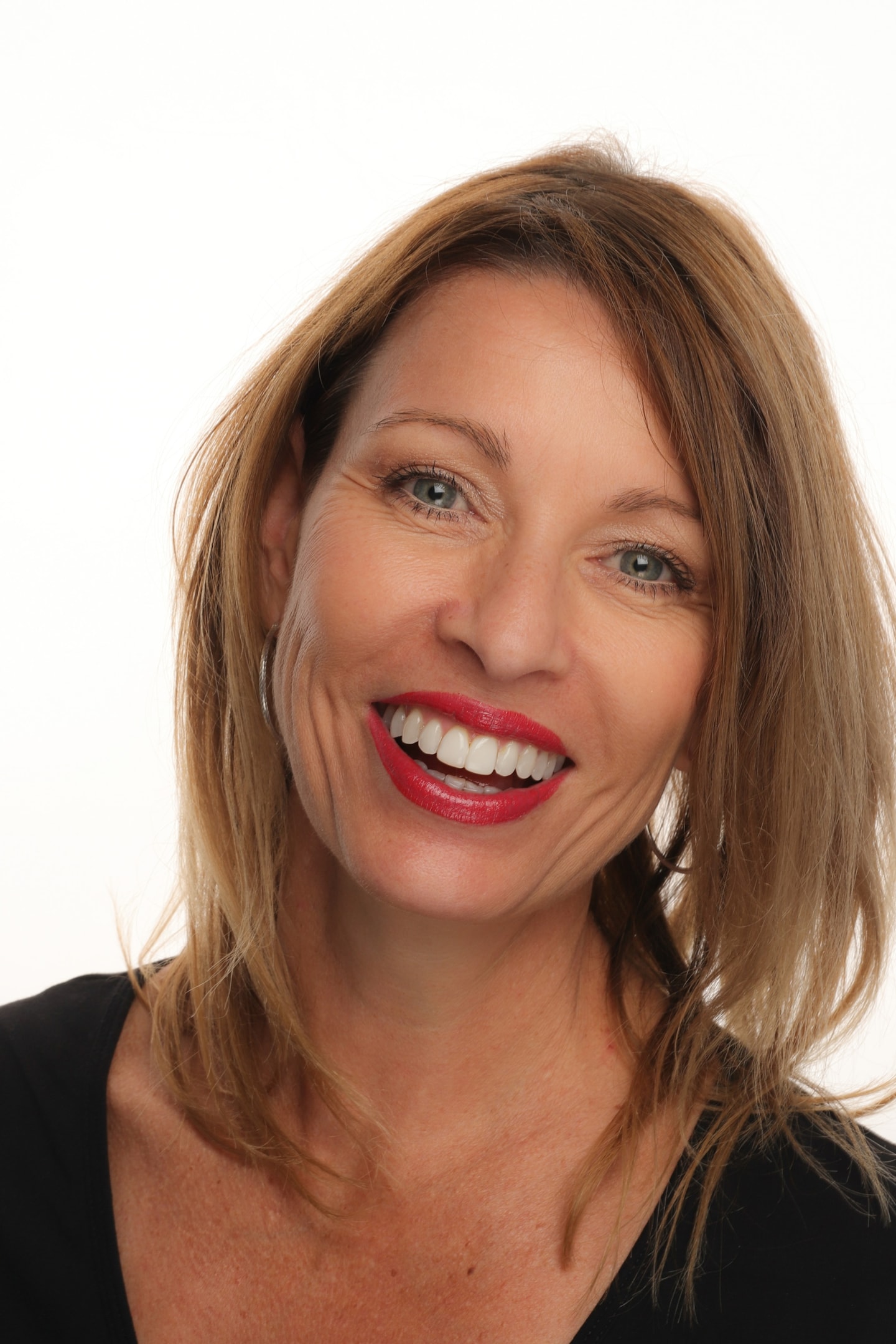 Benefits of digital smile design in cosmetic dentistry.