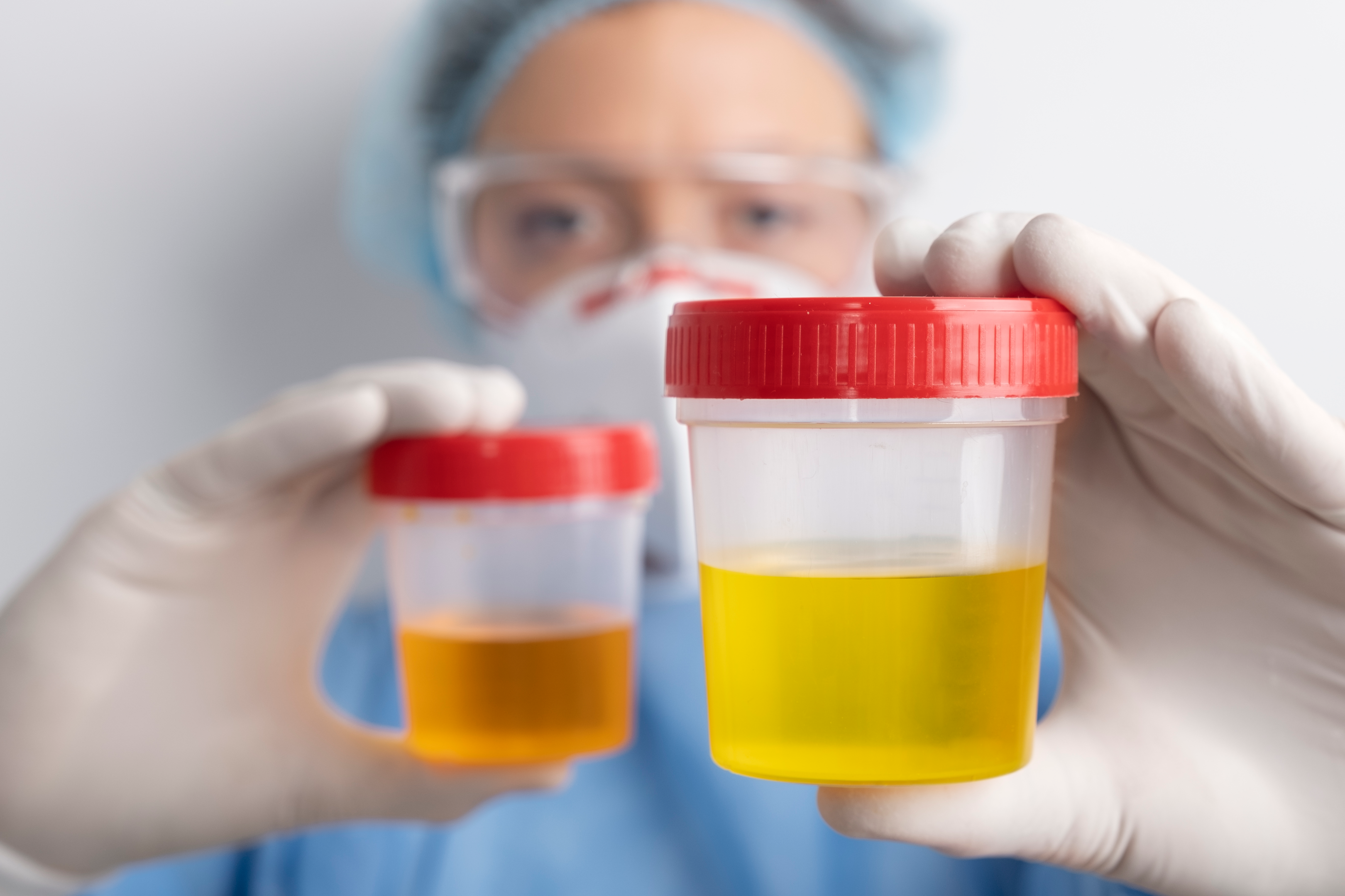 The reproductive health tests are often conducted on urine samples.