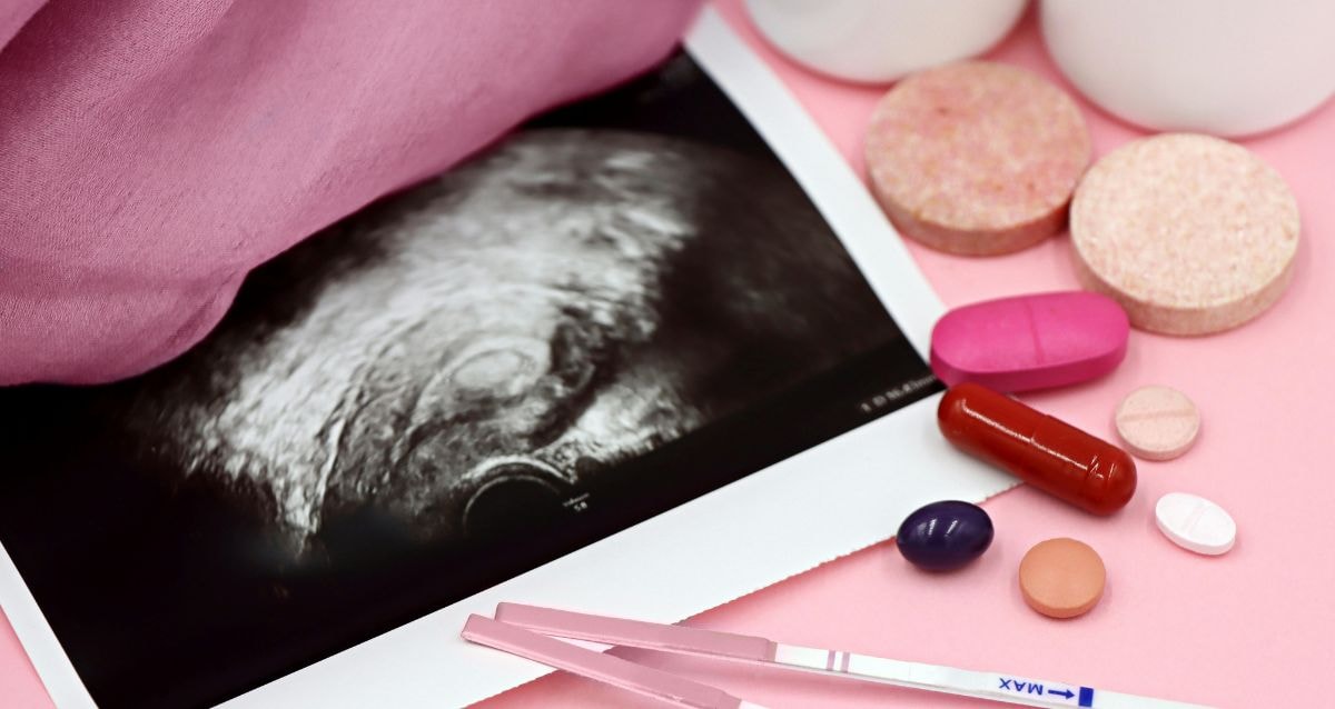 IVF services are not covered by Medicaid