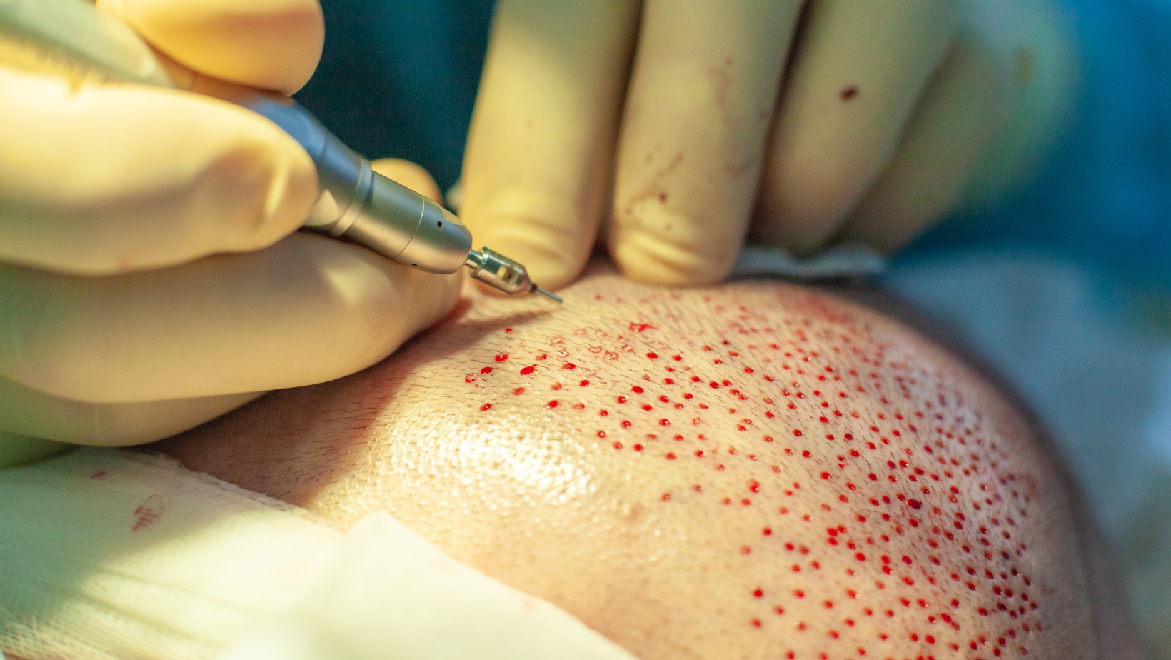 Immediate post-surgery care