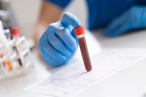 dui-blood-test